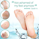 Foot Peel Mask - 2 Pack - For Cracked Heels, Dead Skin & Calluses - Make Your Feet Baby Soft & Get a Smooth Skin, Removes & Repairs Rough Heels, Dry Toe Skin - Exfoliating Peeling Natural Treatment