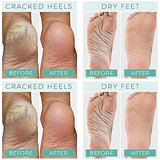 Foot Peel Mask - 2 Pack - For Cracked Heels, Dead Skin & Calluses - Make Your Feet Baby Soft & Get a Smooth Skin, Removes & Repairs Rough Heels, Dry Toe Skin - Exfoliating Peeling Natural Treatment